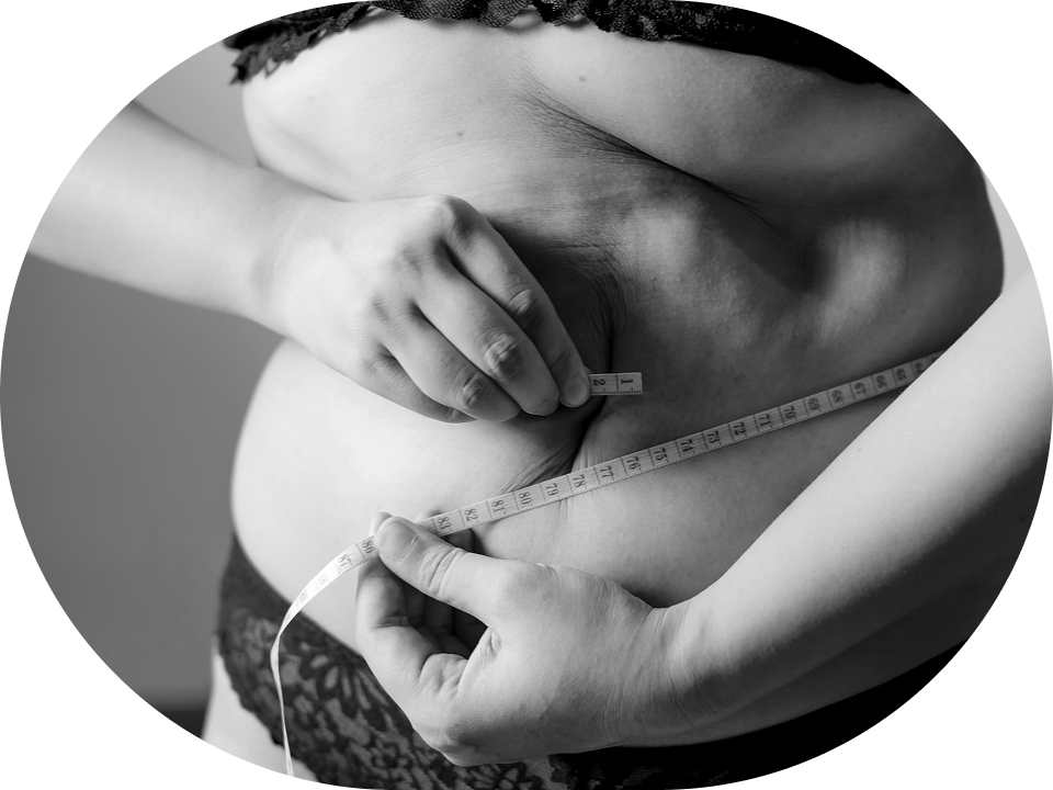 Chirurgie bariatrică